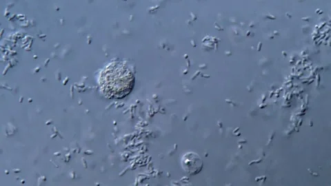 Live Bacteria Sample in Motion, microscope 1000x Vídeos de archivo 317140851
