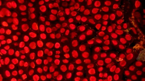 Live cancer cells under microscope Video stock 33661618