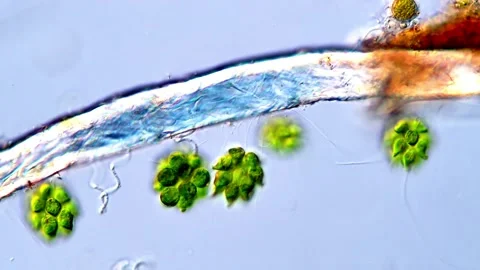 Live Chlorophyta Algae Floating Under Microscope, 400x Video stock 317789901