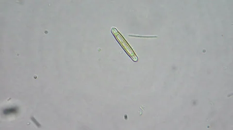 Live diatom algae under microscope, magnification 400X 動画素材 33661287