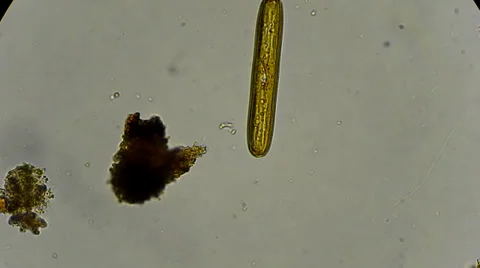 diatoms under microscope 400x