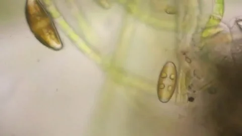 Live Diatom Algae Under Microscope, Magnification 1000X Stock Footage 124208807