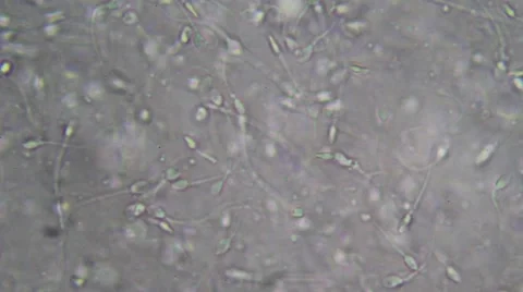 Live human sperm (spermatozoa motion). Image real of a biological microscope Stock Footage 49950331