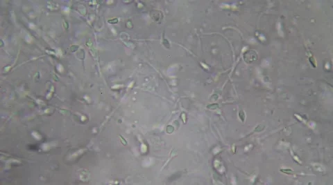 Live human sperm (spermatozoa motion). Image real of a biological microscope Stock Footage 49950358