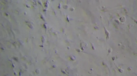 Live human sperm (spermatozoa motion). Image real of a biological microscope Stock Footage 49950377