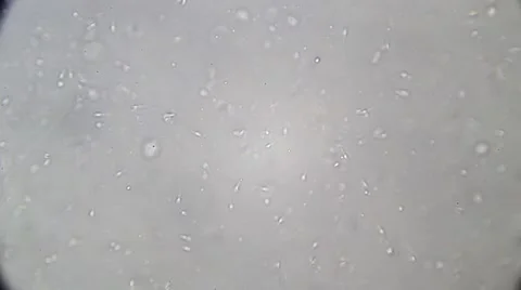 Live human sperm (spermatozoa motion). Image real of a biological microscope Stock Footage 49950407