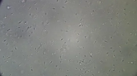 Live human sperm (spermatozoa motion). Image real of a biological microscope Stock Footage 49950417