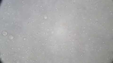 Live human sperm (spermatozoa motion). Image real of a biological microscope Stock Footage 49950451