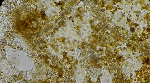 Live infisoria in trap under microscope Видео 33661761