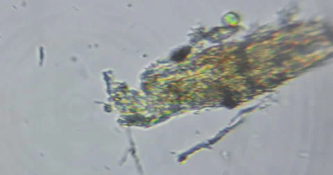 Live microscopic observation of a natural micro ecosystem contained within Stock Footage 328813885