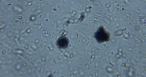 Live microscopic observation of a natural micro ecosystem contained within Stock Footage 328824462