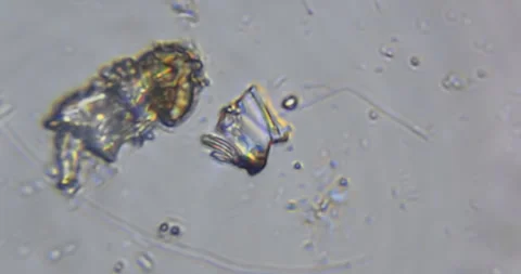Live microscopic observation of a natural micro ecosystem contained within Video stock 328829855