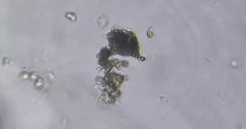 Live microscopic video displaying continuous movement of microorganisms Vidéo 327658137