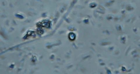 Live microscopic video displaying continuous movement of microorganisms Vidéo 328832500