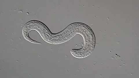 Live nematode larvae in feces sample under microscopy view Vídeos de archivo 306574818