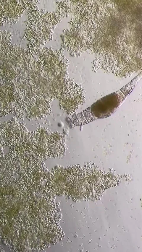 Live Rotifer Feeding Among Clusters of Microorganisms Under Microscope China Stock Footage 339649568