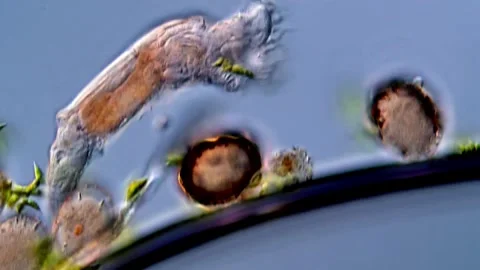 Live rotifer under microscopy view Vidéo 310309274