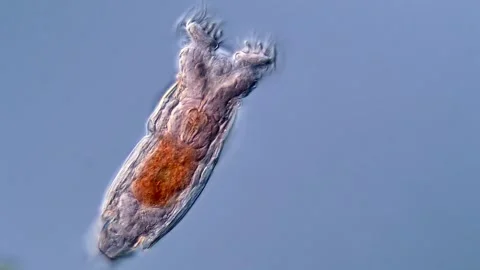 Live rotifera feeding under microscopy view Vídeos de archivo 310309935