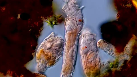 Live rotifers under microscopy view 库存影片 310311446