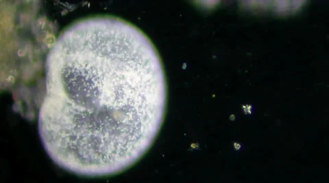 Live single-celled infusoria under microscope (darkfield method) Video stock 33661319