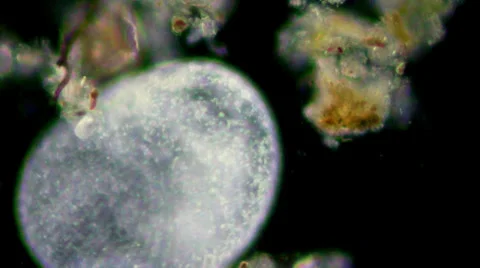 Live single-celled infusoria under microscope (darkfield method) Video stock 33661348