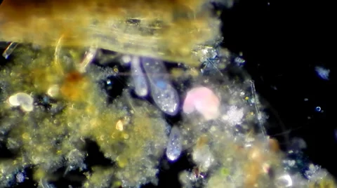 Live single-celled infusoria under microscope (darkfield method) Stock Footage 33661630