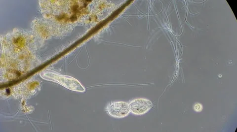 Live single-celled infusoria under microscope (phase-contrast method) 動画素材 33661645