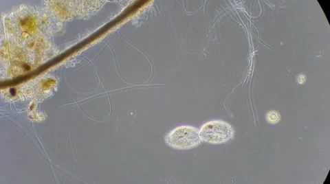 Live single-celled infusoria under microscope (phase-contrast method) Stock Footage 33661652