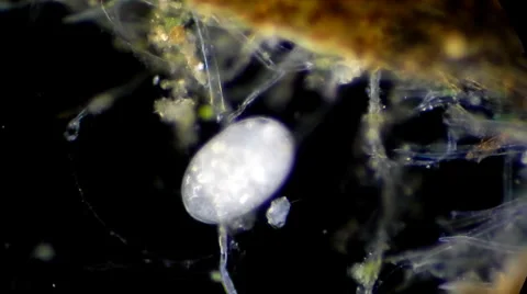 Live single-celled infusoria under microscope (darkfield method) Stock Footage 33661665