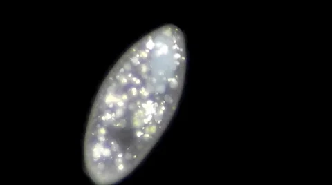 Live single-celled infusoria under microscope (darkfield method) Stock Footage 33661677