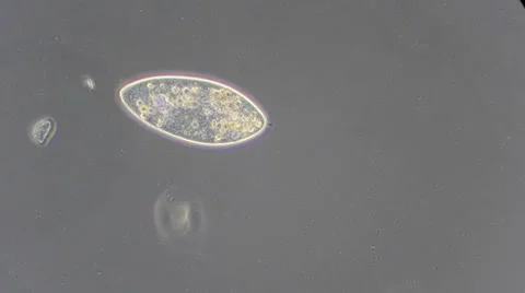 Live single-celled infusoria under microscope (phase-contrast method) Stock Footage 33661736