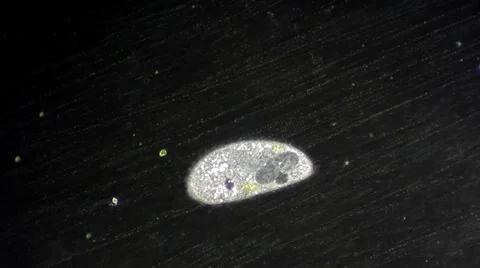 Live single-celled infusoria under microscope (darkfield method) Video stock 33661773
