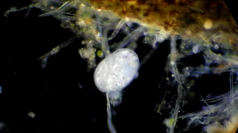 Live single-celled infusoria under microscope (darkfield method) Video stock 33661799