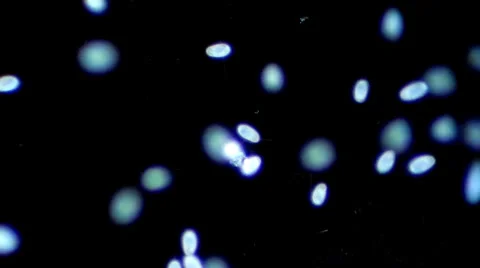 Live single-celled infusoria under microscope (darkfield method) Video stock 33661806