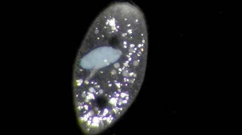 Live single-celled infusoria under microscope (darkfield method) Video stock 33661834