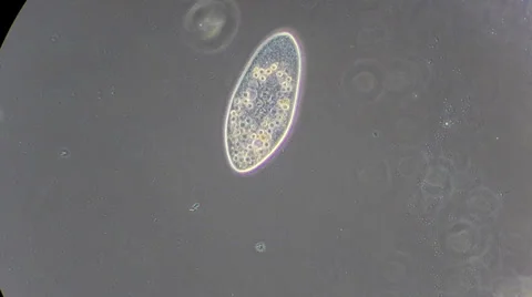 Live single-celled infusoria under microscope (phase-contrast method) Video stock 33661844