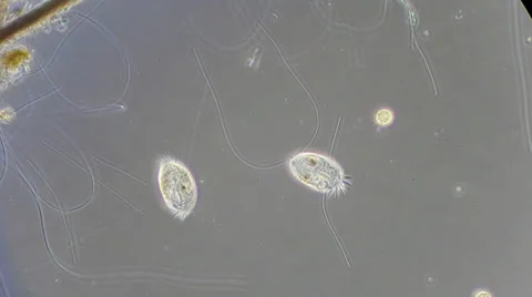 Live single-celled infusoria under microscope (phase-contrast method) Video stock 33661853