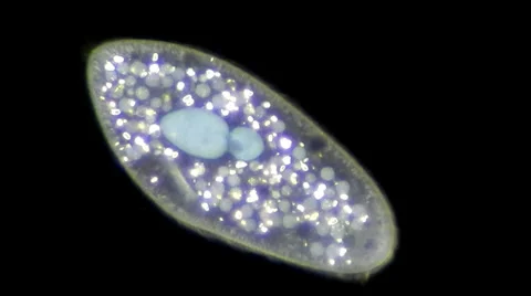 Live single-celled infusoria under microscope (darkfield method) Video stock 33661855