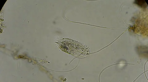 Live single-celled infusoria under microscope Video stock 33661856