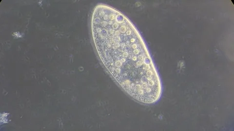 Live single-celled infusoria under microscope (phase-contrast method) Video stock 33661863