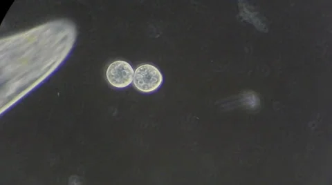 Live single-celled infusoria under microscope (phase-contrast method) Video stock 33661866