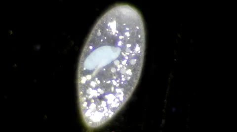 Live single-celled infusoria under microscope (darkfield method) Video stock 33661882