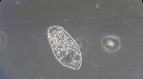 Live single-celled infusoria under microscope (phase-contrast method) Video stock 33661885