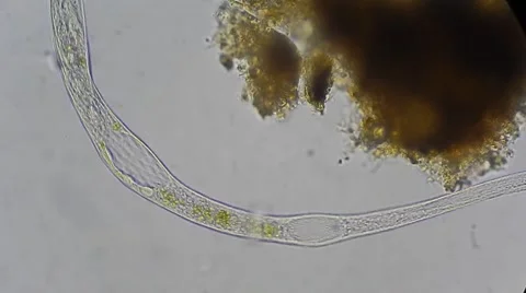Live Single-Celled Infusoria Under Microscope Vídeos de archivo 54612833