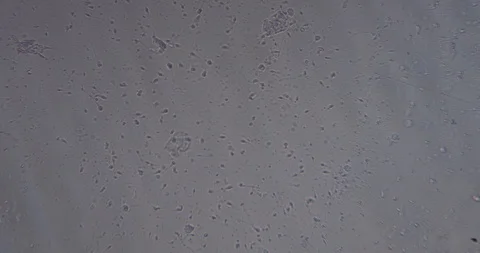 Live sperm under a microscope Stock Footage 88427678