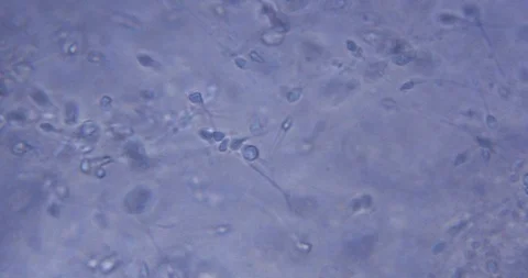 Live spermatozoa under a microscope Stock Footage 91398860
