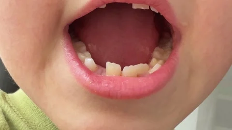 Lively Young Boy Displaying Engaging Smile And Playful Demeanor In Brightly Lit Video stock 336466763