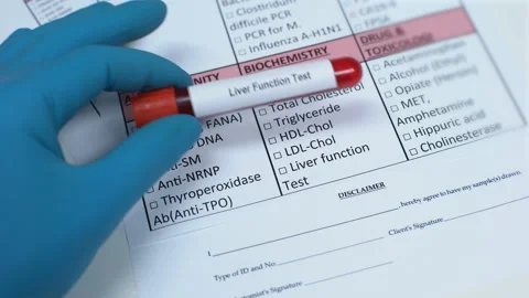 Liver function, doctor checking name in lab blank, showing blood sample in tube Stock Footage 103441581