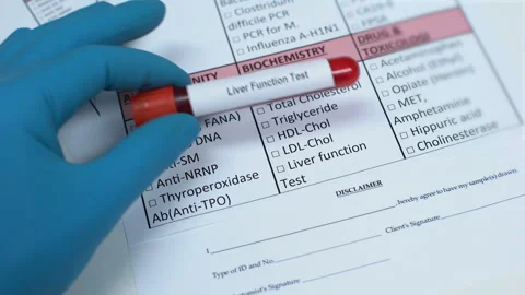 Liver function, doctor checking name in lab blank, showing blood sample in tube Stock Footage 103452480