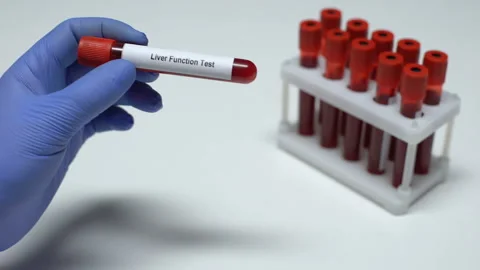 Liver function, doctor shows blood sample in tube, lab research, health checkup Stock Footage 105201267